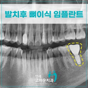 나성동추천치과