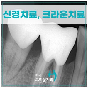 다정동신경치료잘하는곳