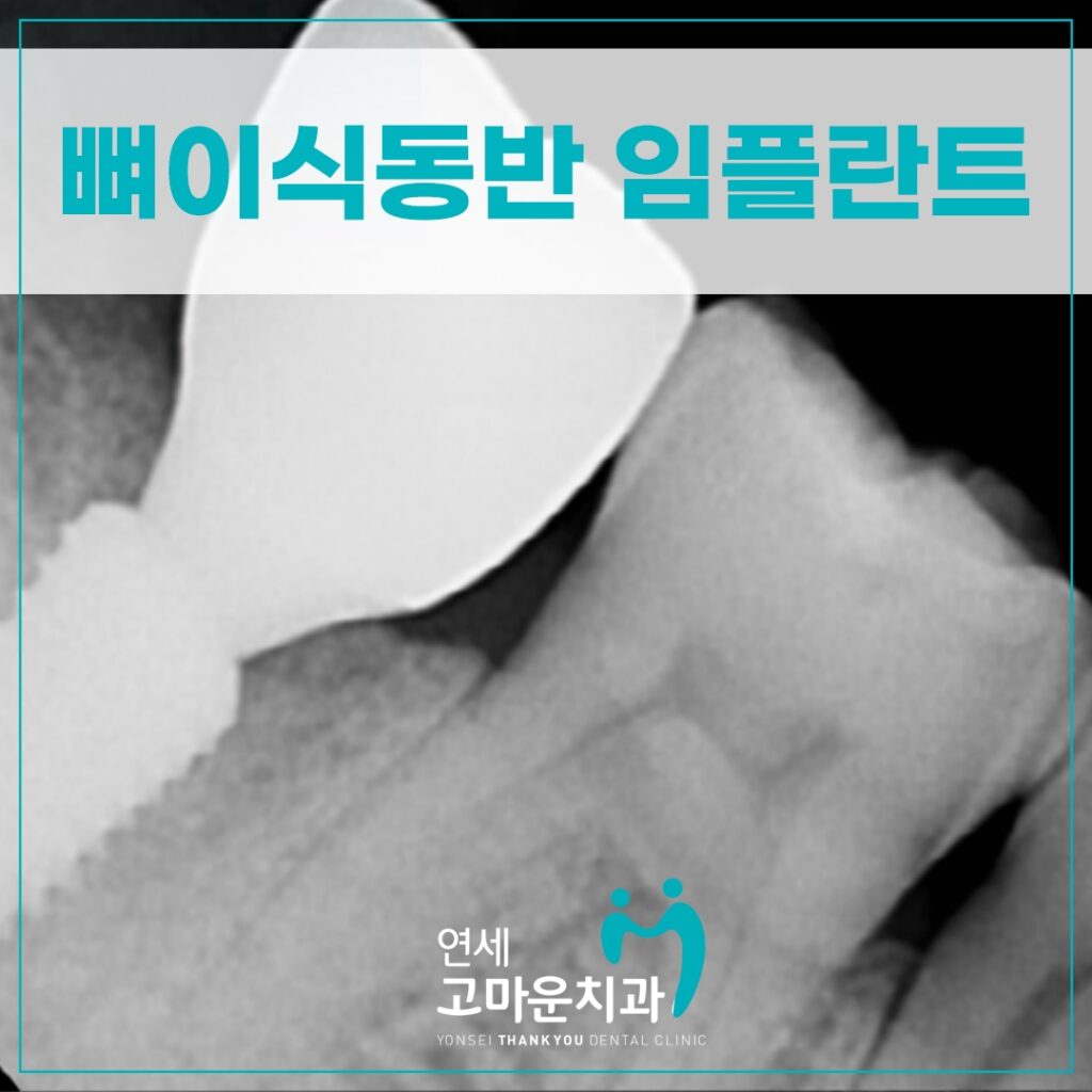 다정동임플란트치과