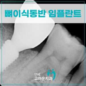 다정동임플란트치과