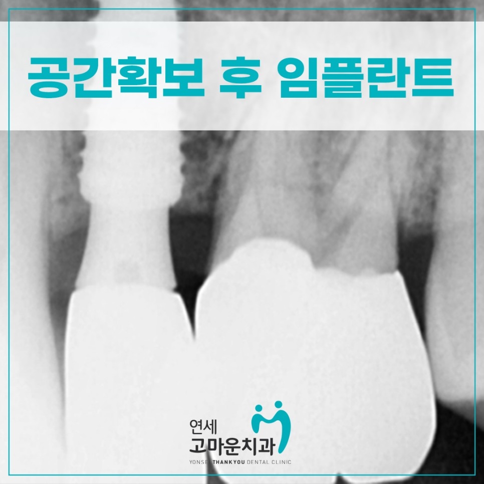 다정동추천치과