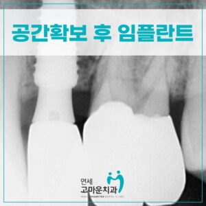 다정동추천치과