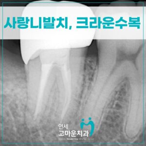 다정동충치치료