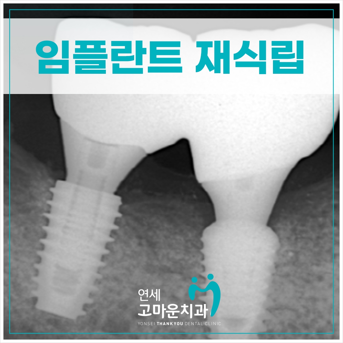 새롬동치과