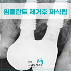 세종다정동치과