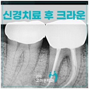 세종신경치료