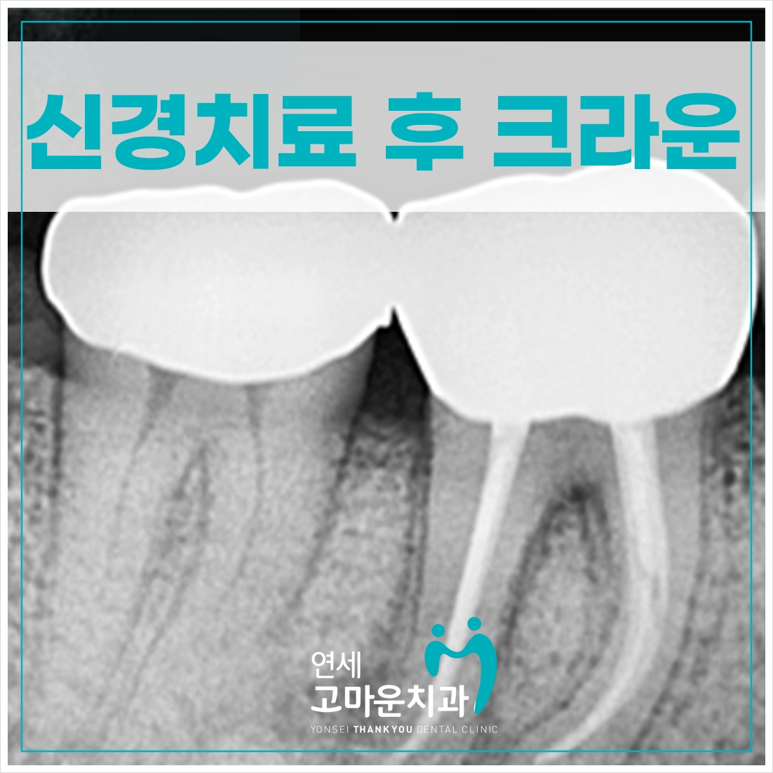 세종신경치료