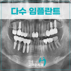 첫마을임플란트잘하는곳