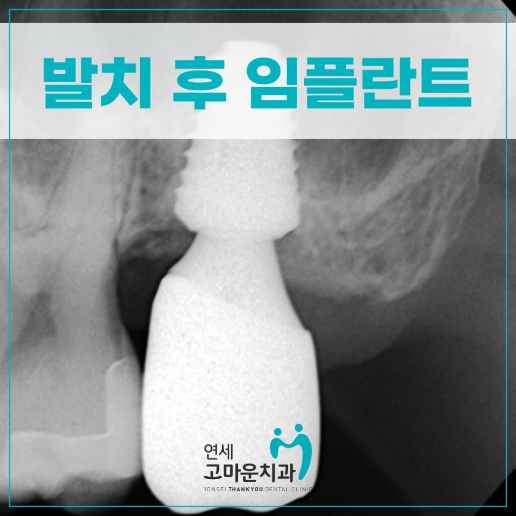 한솔동임플란트치과