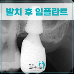 한솔동임플란트치과