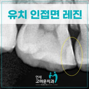 한솔동충치치료잘하는곳