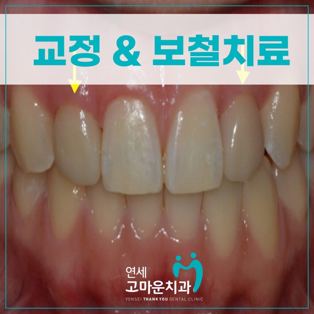 첫마을치과잘하는곳
