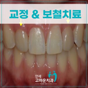 첫마을치과잘하는곳