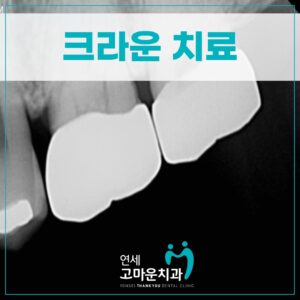한솔동치과잘하는곳