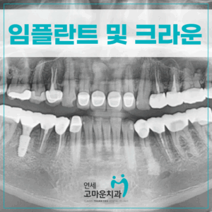 첫마을치과추천1