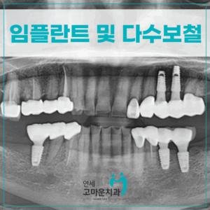 한솔동치과추천1